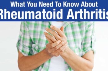 Information on Rheumatoid Arthritis